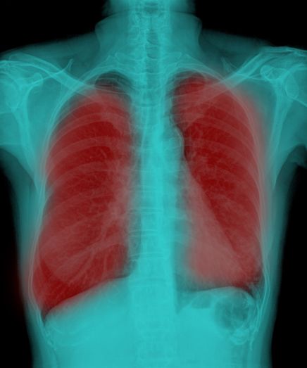 shutterstock 219255739 small